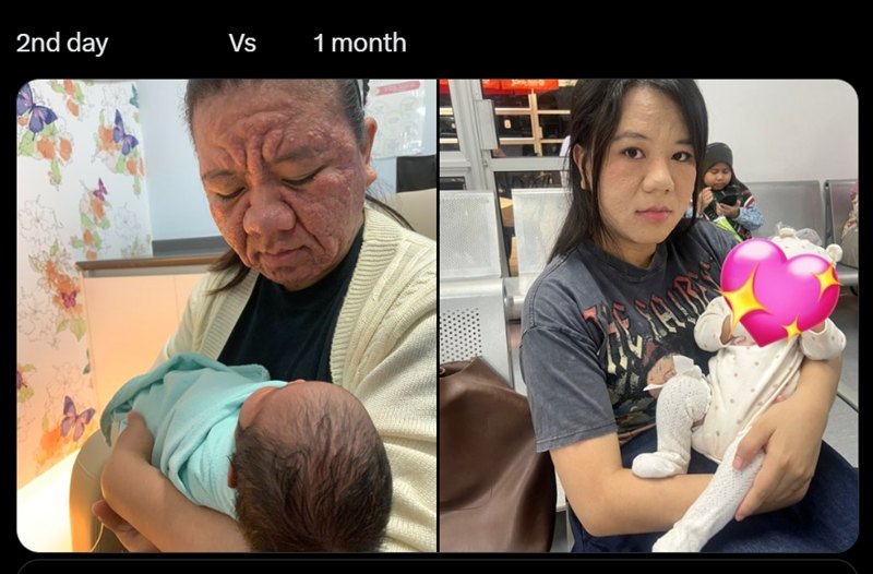 เผยภาพล่าสุด คุณแม่ตั้งครรภ์จนสิวผุด หลังคลอดผ่านไป 1 เดือน เผยภาพล่าสุด คุณแม่ตั้งครรภ์จนสิวผุด หลังคลอดผ่านไป 1 เดือน