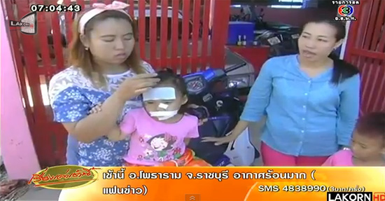 หมากัดเด็ก หมากัดเด็ก