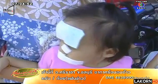 หมากัดเด็ก หมากัดเด็ก