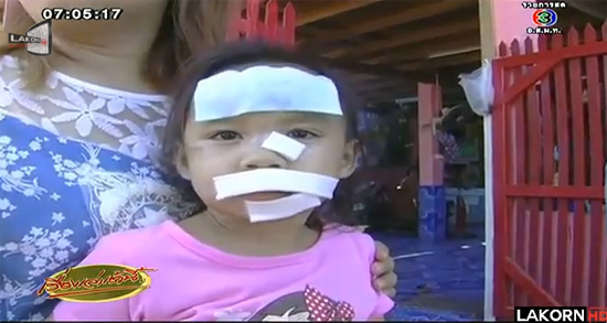 หมากัดเด็ก หมากัดเด็ก