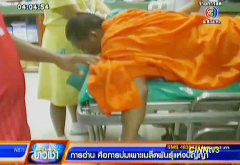 พระสยาม โดนฟัน พระสยาม โดนฟัน