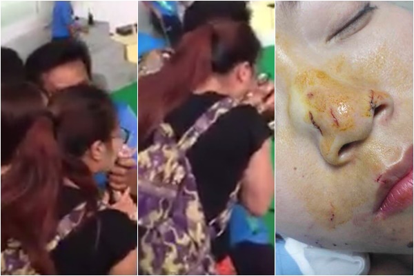 งูกัดหน้า งูกัดหน้า