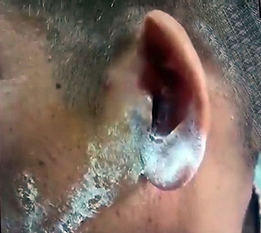 กาวหยอดหู กาวหยอดหู