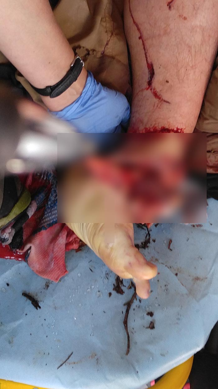 กินเนื้อมนุษย์ กินเนื้อมนุษย์