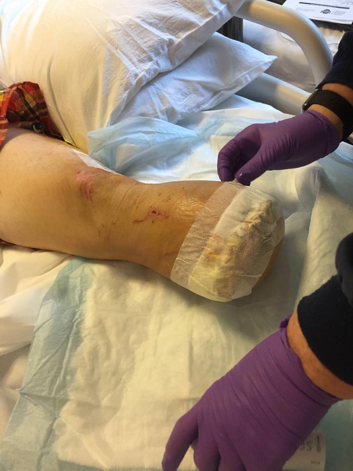 กินเนื้อมนุษย์ กินเนื้อมนุษย์