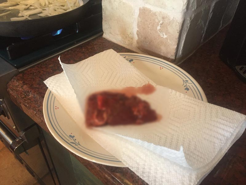 กินเนื้อมนุษย์ กินเนื้อมนุษย์