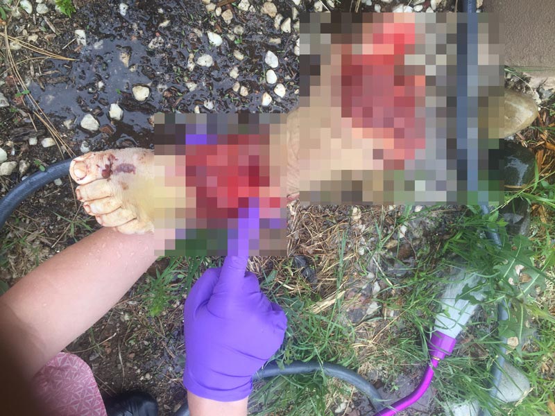 กินเนื้อมนุษย์ กินเนื้อมนุษย์