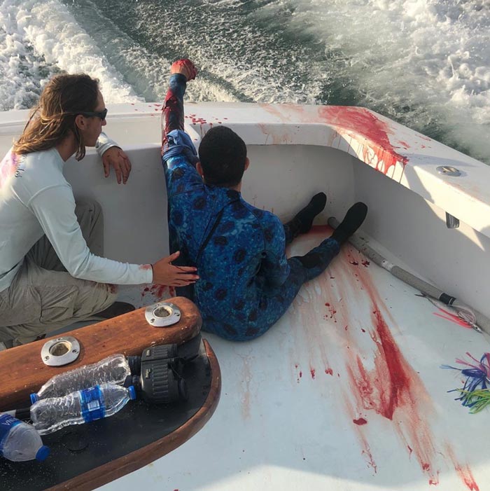 ถูกฉลามกัด ถูกฉลามกัด