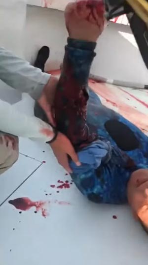 ถูกฉลามกัด ถูกฉลามกัด