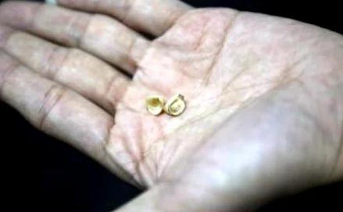 ฟันหัก ฟันหัก