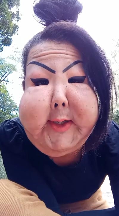 ศัลยกรรมทำหน้าพัง ศัลยกรรมทำหน้าพัง