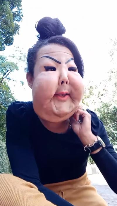 ศัลยกรรมทำหน้าพัง ศัลยกรรมทำหน้าพัง