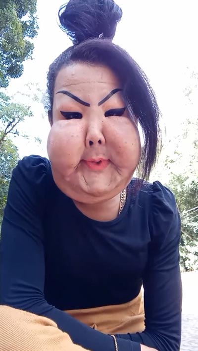 ศัลยกรรมทำหน้าพัง ศัลยกรรมทำหน้าพัง