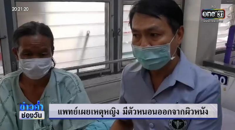 หนอนออกจากร่าง หนอนออกจากร่าง