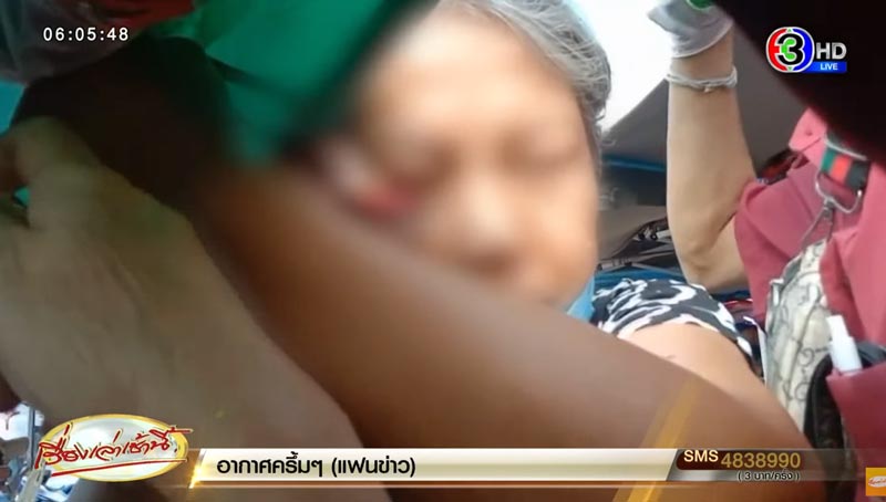 ก้านร่มทิ่มตา ก้านร่มทิ่มตา