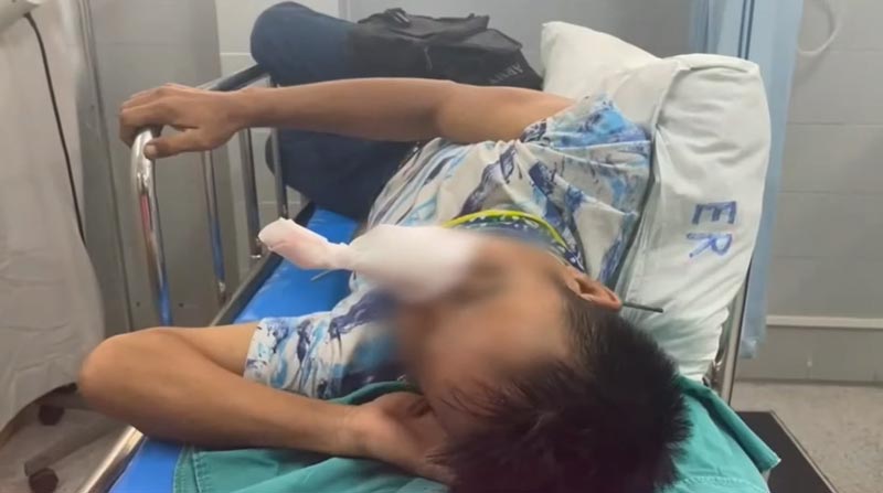 ลูกดอกยิงปลาทะลุหน้า ลูกดอกยิงปลาทะลุหน้า