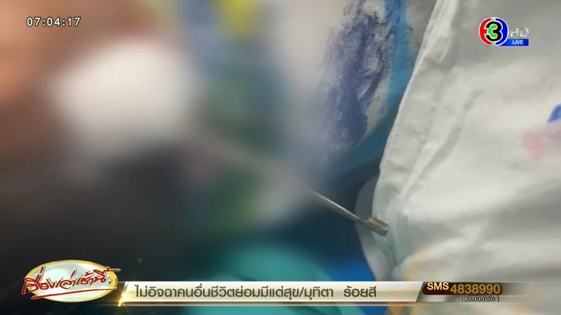 ลูกดอกยิงปลาทะลุหน้า ลูกดอกยิงปลาทะลุหน้า