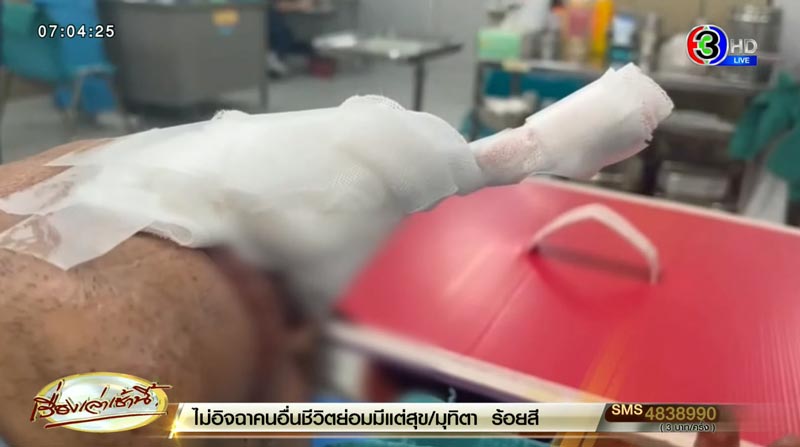 ลูกดอกยิงปลาทะลุหน้า ลูกดอกยิงปลาทะลุหน้า