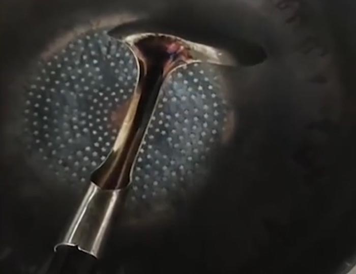 ลืมปิดเตาแก๊ส ลืมปิดเตาแก๊ส