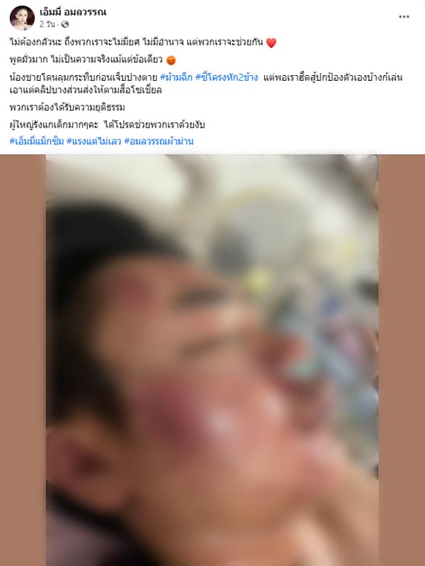 น้องชายเอ็มมี่ แม็กซิม ถูกการ์ดทำร้าย น้องชายเอ็มมี่ แม็กซิม ถูกการ์ดทำร้าย