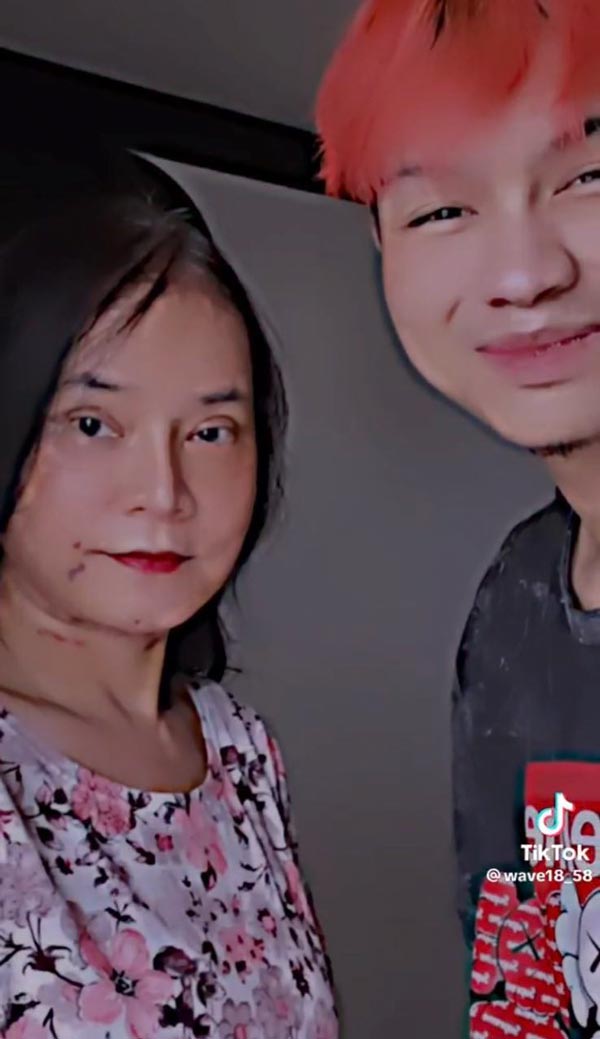 พี่พร คู่รักต่างวัย ศัลยกรรมดึงหน้า พี่พร คู่รักต่างวัย ศัลยกรรมดึงหน้า