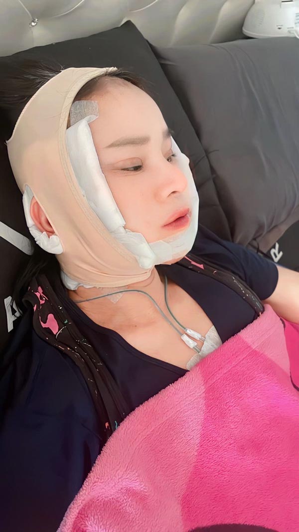 พี่พร คู่รักต่างวัย ศัลยกรรมดึงหน้า พี่พร คู่รักต่างวัย ศัลยกรรมดึงหน้า