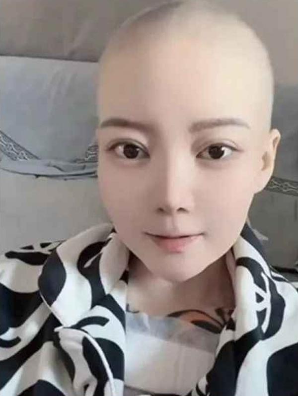 วิถีชีวิตเน็ตไอดอล เสียชีวิตด้วยโรคมะเร็ง วิถีชีวิตเน็ตไอดอล เสียชีวิตด้วยโรคมะเร็ง