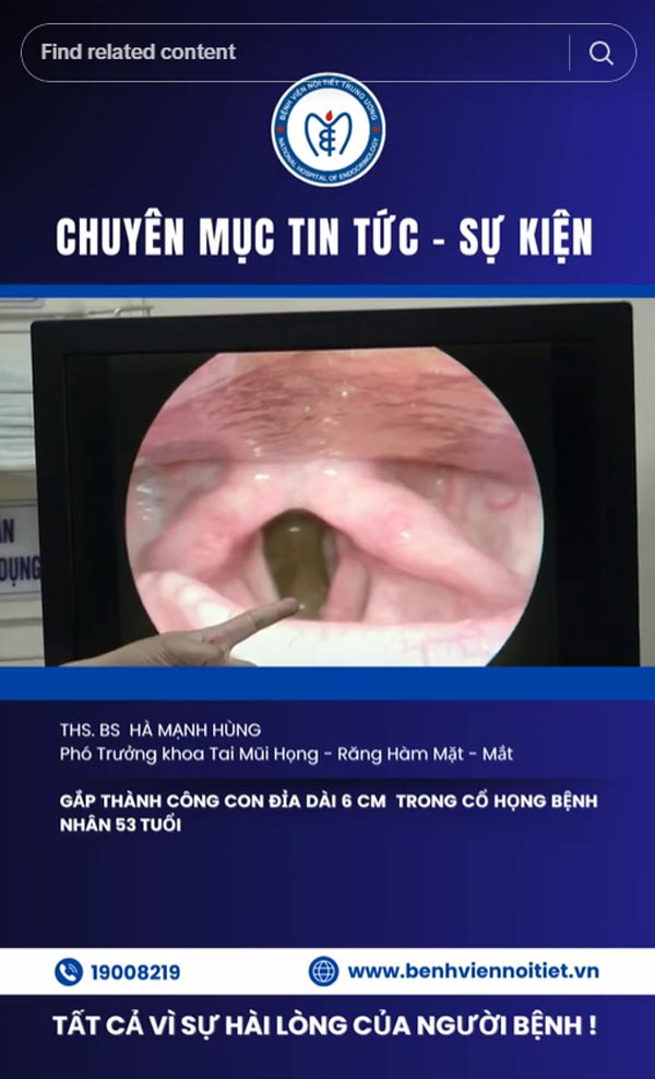 ปลิงในคอ ปลิงในคอ