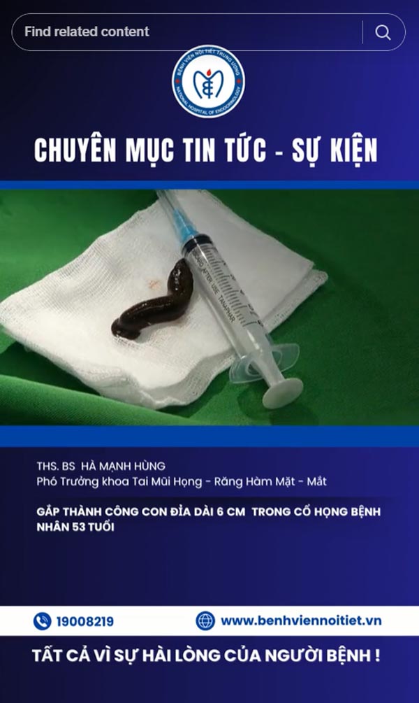 ปลิงในคอ ปลิงในคอ