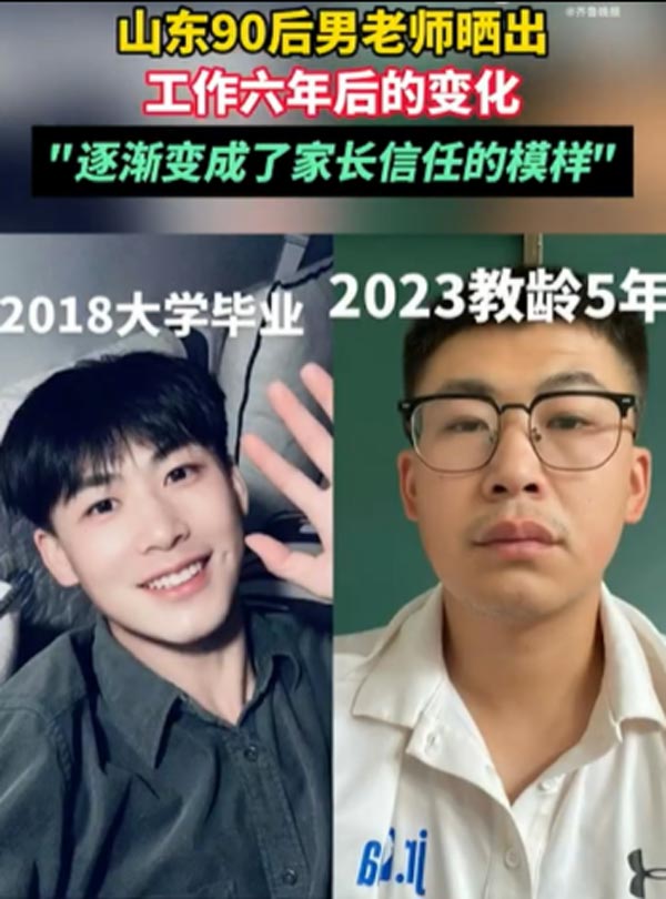 ภาพก่อนหลัง ครูทำงานหนัก ภาพก่อนหลัง ครูทำงานหนัก