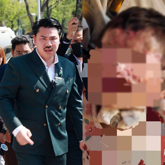 แม่ลูก ถูกน้ำกรดสาด แม่ลูก ถูกน้ำกรดสาด