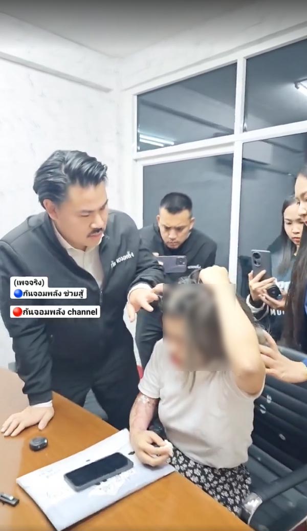 แม่ลูก ถูกน้ำกรดสาด แม่ลูก ถูกน้ำกรดสาด