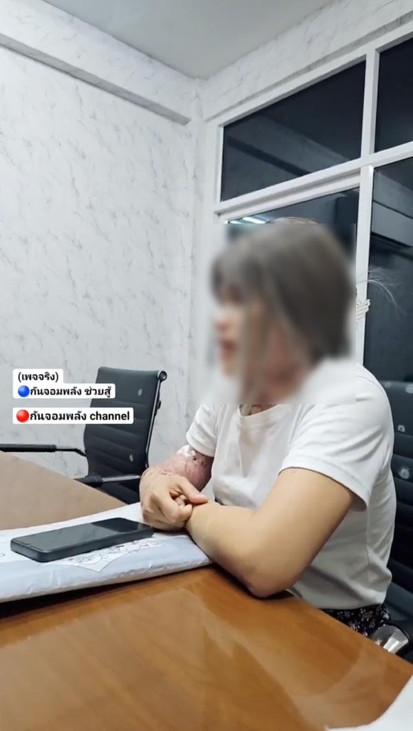 แม่ลูก ถูกน้ำกรดสาด แม่ลูก ถูกน้ำกรดสาด