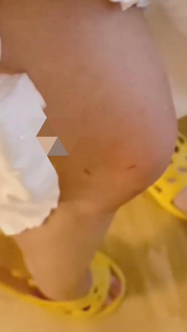 ฟ้องคาเฟ่แมว ลูกค้าโดนแมวกัด ฟ้องคาเฟ่แมว ลูกค้าโดนแมวกัด