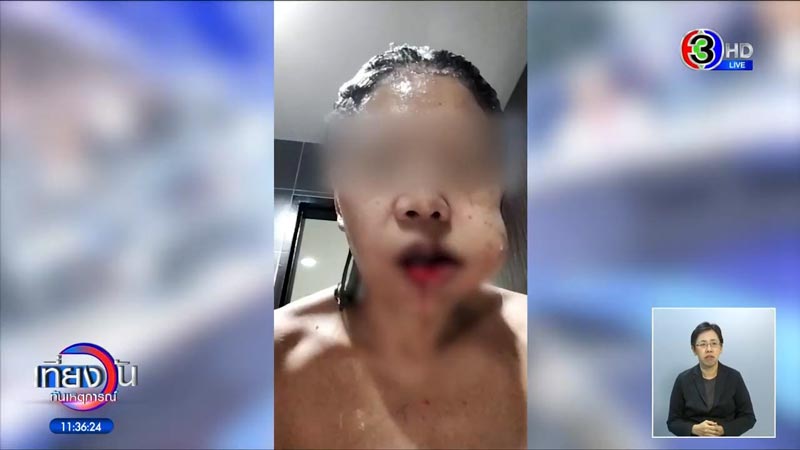 คลินิกผ่าตัดทำลักยิ้มพลาด คลินิกผ่าตัดทำลักยิ้มพลาด