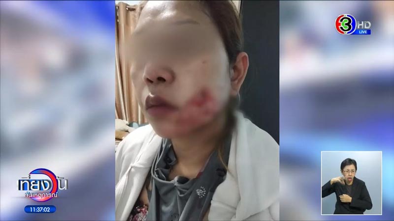 ผ่าตัดทำลักยิ้ม ผ่าตัดทำลักยิ้ม