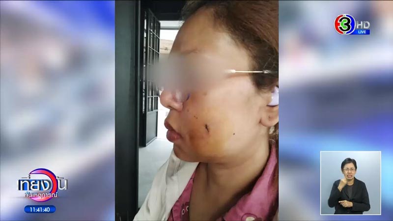 ศัลยกรรมลักยิ้ม ศัลยกรรมลักยิ้ม