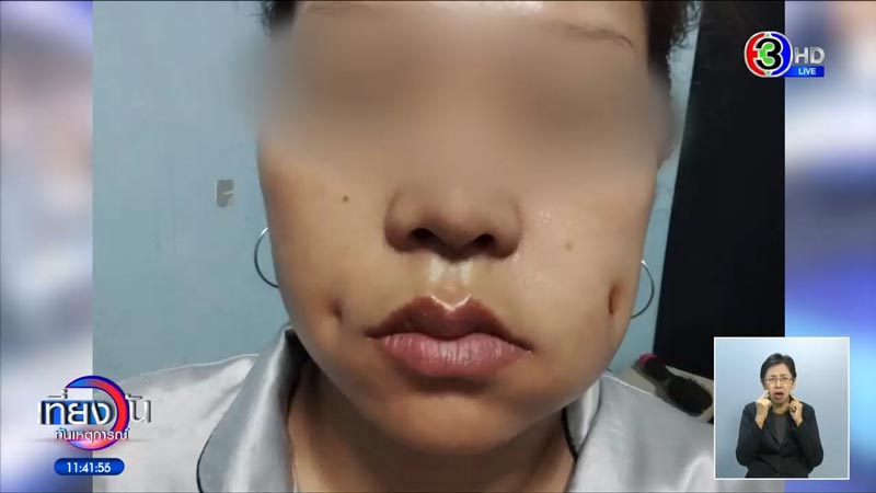 ทำลักยิ้ม ทำลักยิ้ม