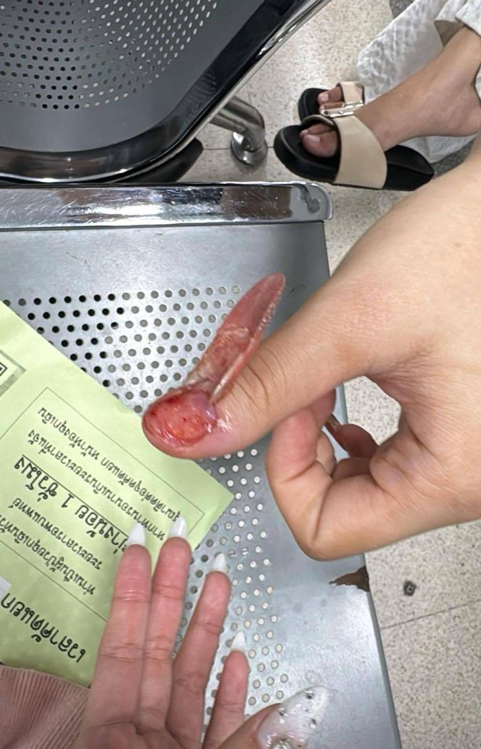 แฉหนุ่ม นศ. เกียรตินิยม ม. ดัง ทำร้ายแฟน แฉหนุ่ม นศ. เกียรตินิยม ม. ดัง ทำร้ายแฟน