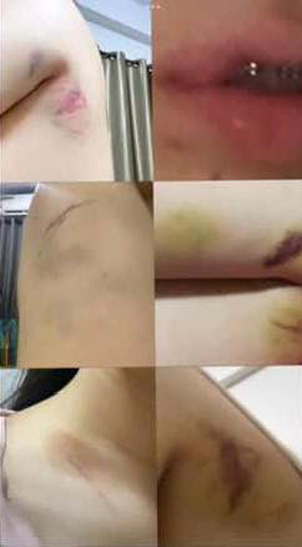 แฉหนุ่ม นศ. เกียรตินิยม ม. ดัง ทำร้ายแฟน แฉหนุ่ม นศ. เกียรตินิยม ม. ดัง ทำร้ายแฟน