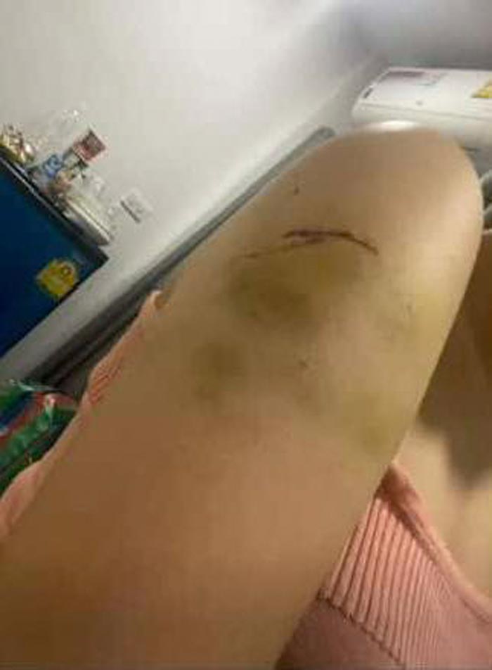 แฉหนุ่ม นศ. เกียรตินิยม ม. ดัง ทำร้ายแฟน แฉหนุ่ม นศ. เกียรตินิยม ม. ดัง ทำร้ายแฟน