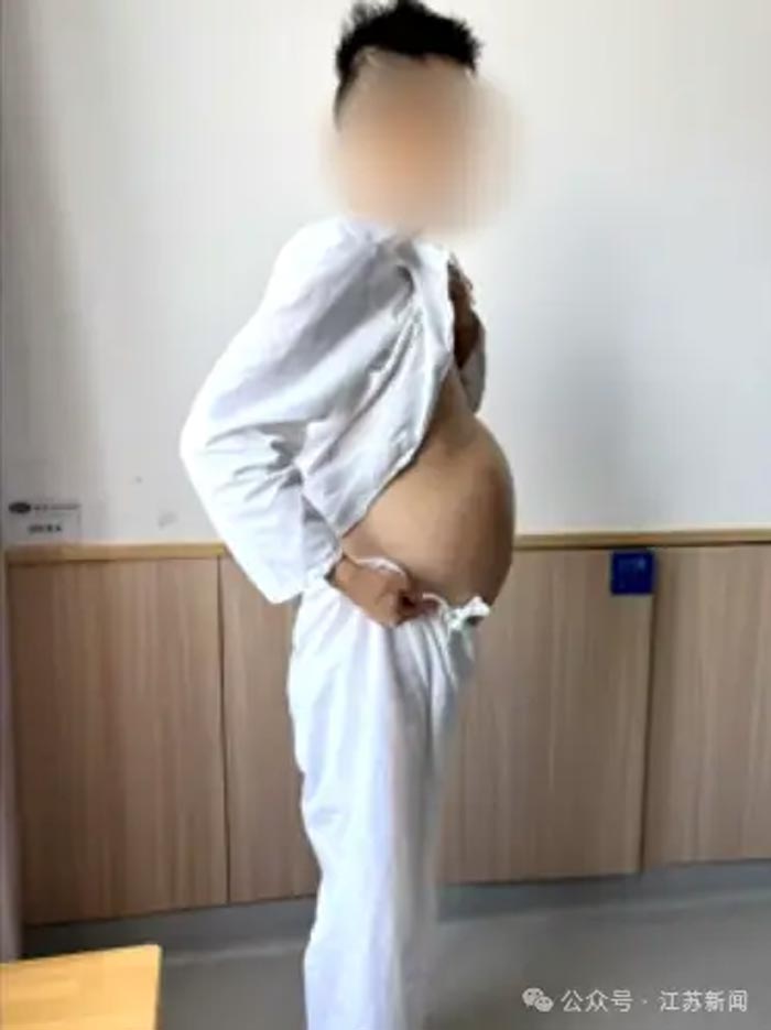 ไม่อุจจาระ 4 เดือน ไม่อุจจาระ 4 เดือน