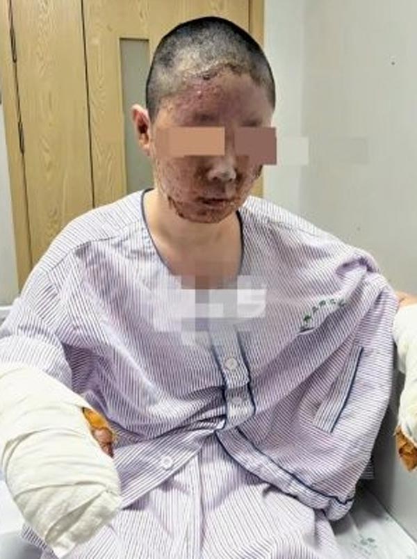 บิวตี้บล็อกเกอร์ บ้านไฟไหม้เสียโฉม บิวตี้บล็อกเกอร์ บ้านไฟไหม้เสียโฉม