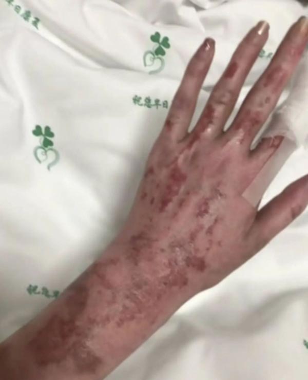 บิวตี้บล็อกเกอร์ บ้านไฟไหม้เสียโฉม บิวตี้บล็อกเกอร์ บ้านไฟไหม้เสียโฉม