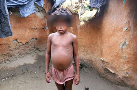 ดูดนมหมาประทังชีวิต