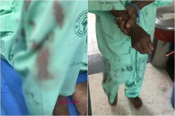 หลานโวยพยาบาล ถอดสายน้ำเกลือตาเลือดสาด หลานโวยพยาบาล ถอดสายน้ำเกลือตาเลือดสาด