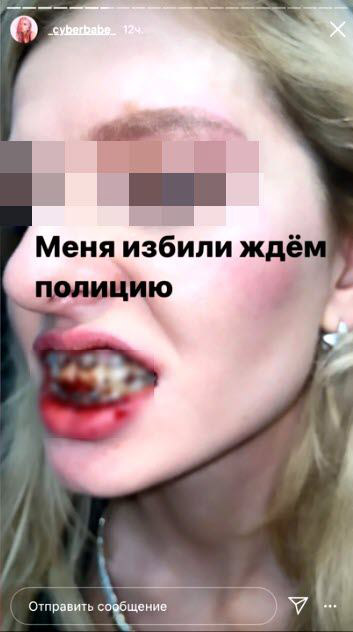 ยูทูบเบอร์จับหัวนางแบบกระแทกโต๊ะ ยูทูบเบอร์จับหัวนางแบบกระแทกโต๊ะ