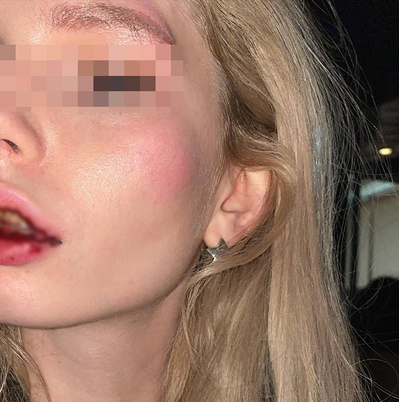 ยูทูบเบอร์จับหัวนางแบบกระแทกโต๊ะ ยูทูบเบอร์จับหัวนางแบบกระแทกโต๊ะ