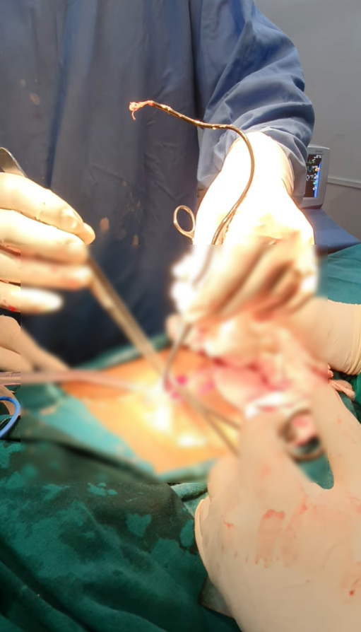 หนุ่มสอดสายชาร์จเข้าอวัยวะเพศ หนุ่มสอดสายชาร์จเข้าอวัยวะเพศ