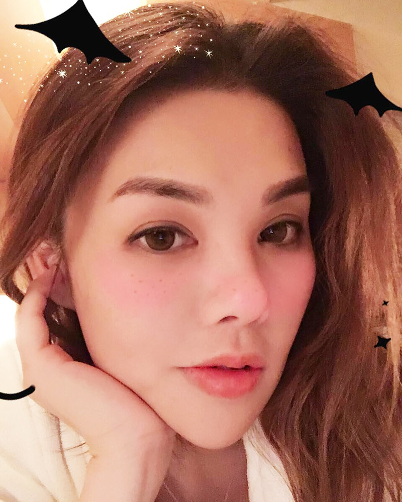 บอนนี่ เอวิต้า หลอ ศัลยกรรมหน้าอกตาย บอนนี่ เอวิต้า หลอ ศัลยกรรมหน้าอกตาย